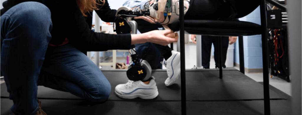 La fabrication d’une jambe bionique en accès libre !